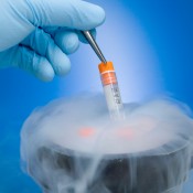 Cryopreservation